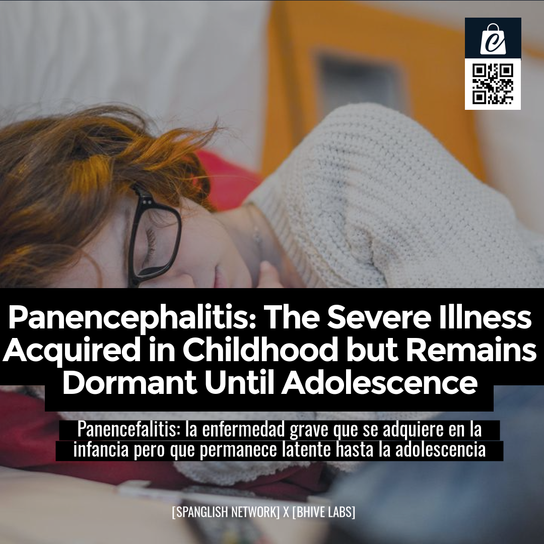 Panencephalitis: The Severe Illness Acquired in Childhood but Remains Dormant Until Adolescence