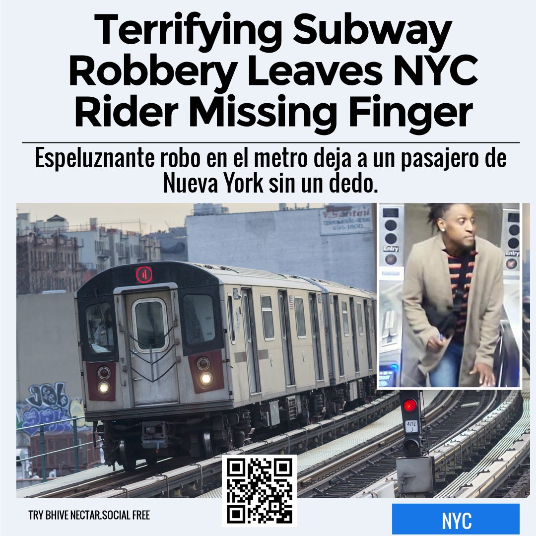 Terrifying Subway Robbery Leaves NYC Rider Missing Finger