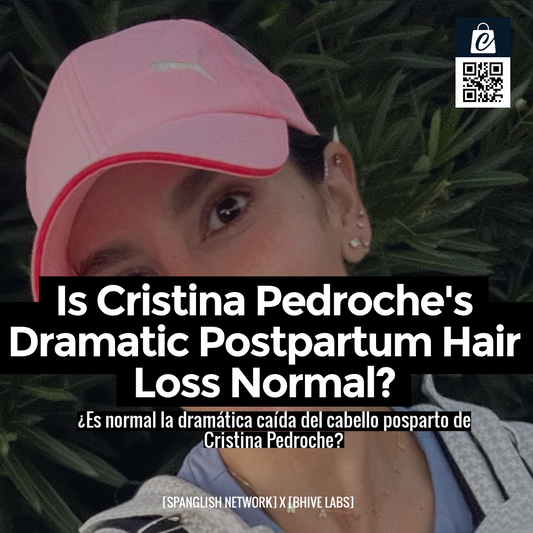 Is Cristina Pedroche's Dramatic Postpartum Hair Loss Normal?