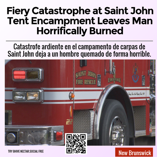 Fiery Catastrophe at Saint John Tent Encampment Leaves Man Horrifically Burned