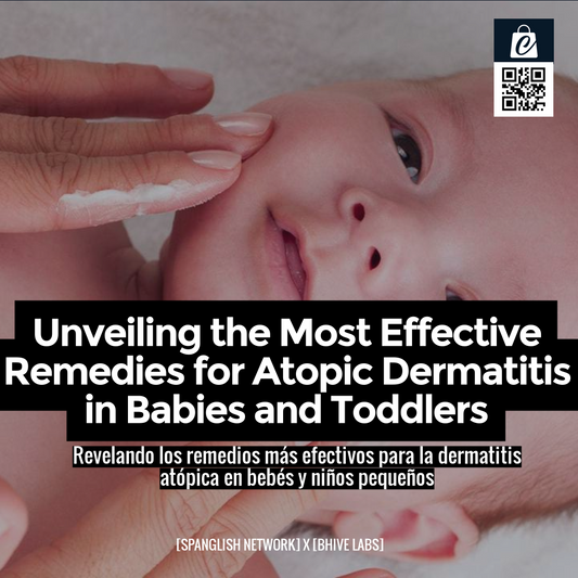 Unveiling the Most Effective Remedies for Atopic Dermatitis in Babies and Toddlers