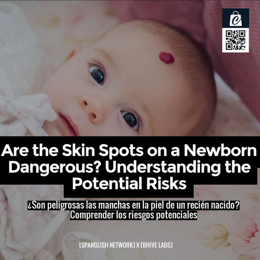 Are the Skin Spots on a Newborn Dangerous? Understanding the Potential Risks