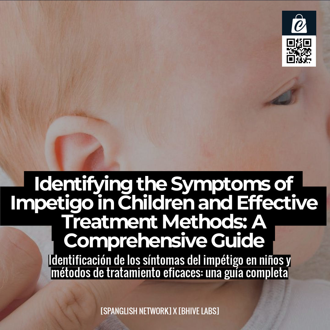 Identifying the Symptoms of Impetigo in Children and Effective Treatment Methods: A Comprehensive Guide